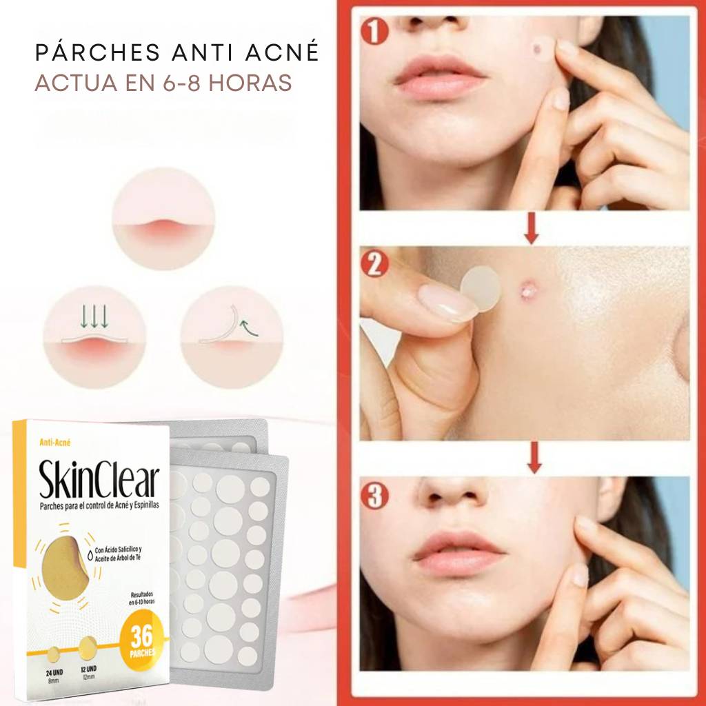 Parches Anti acné - ¡El secreto para decirle adiós a los granos mientras duermes!