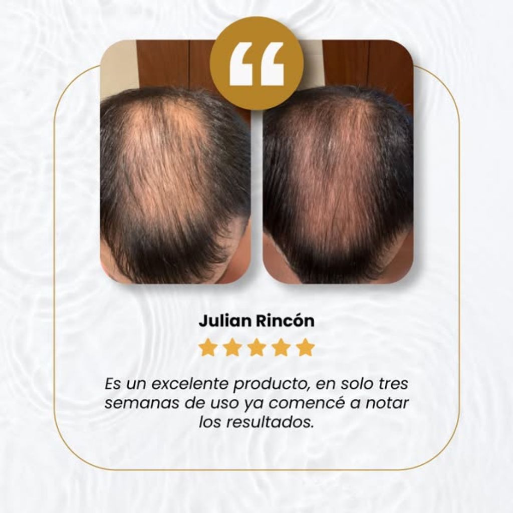 Jabón Polygonum™ - El secreto asiático para el crecimiento del cabello