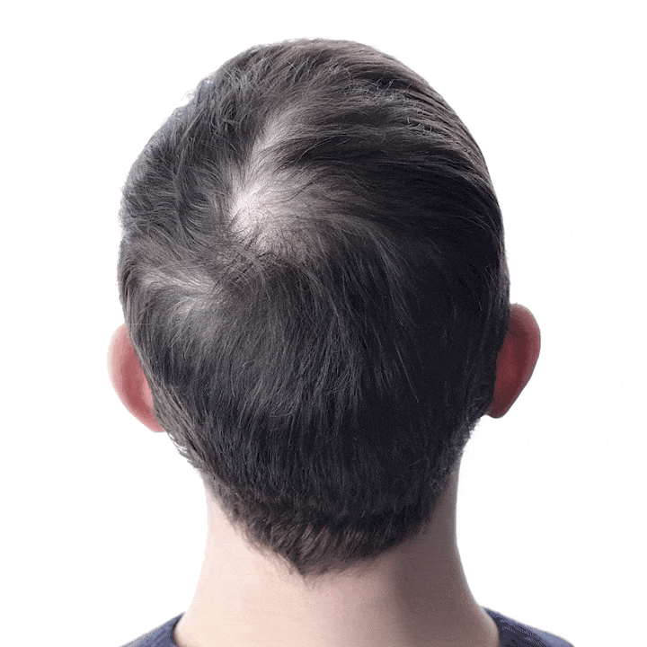 Aceite Batana ORIGINAL x2: El Secreto Ancestral para Prevenir la Caída del Cabello y Estimular el Crecimiento