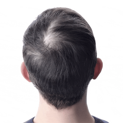 Aceite Batana ORIGINAL x2: El Secreto Ancestral para Prevenir la Caída del Cabello y Estimular el Crecimiento