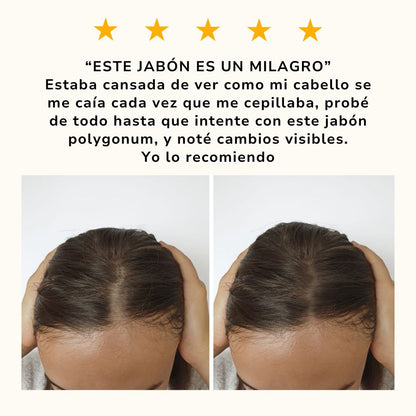 Compras 1 Llevas 4 | Jabón Polygonum EL ORIGINAL | CABELLO MÁS ABUNDANTE EN POCAS SEMANAS