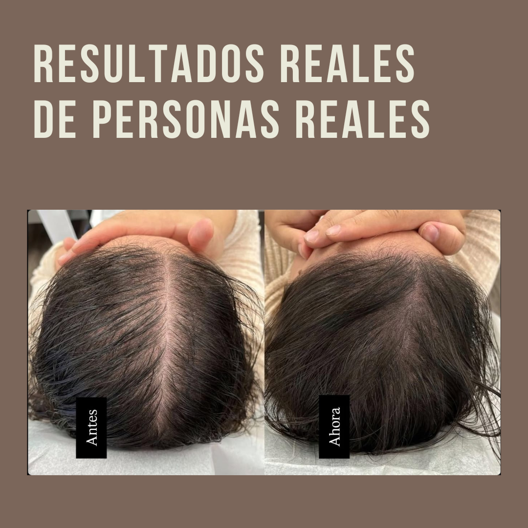 Compras 1 Llevas 4 | Jabón Polygonum EL ORIGINAL | CABELLO MÁS ABUNDANTE EN POCAS SEMANAS