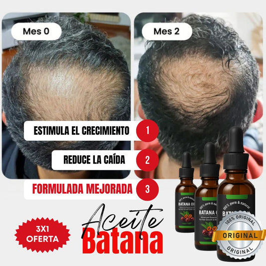 Kit 3x1 | Aceite de Batana ORIGINAL (30ml) + ROMERO | Recupera tu Cabello Perdido en Tan Solo 8 Semanas