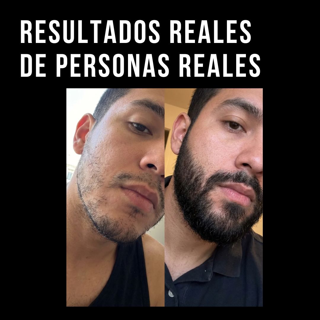 Compras 1 Llevas 2 | Bálsamo APOLO EL ORIGINAL (100ml) | BARBA MÁS ABUNDANTE EN POCAS SEMANAS