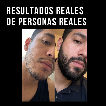 Compras 1 Llevas 2 | Bálsamo APOLO EL ORIGINAL (100ml) | BARBA MÁS ABUNDANTE EN POCAS SEMANAS