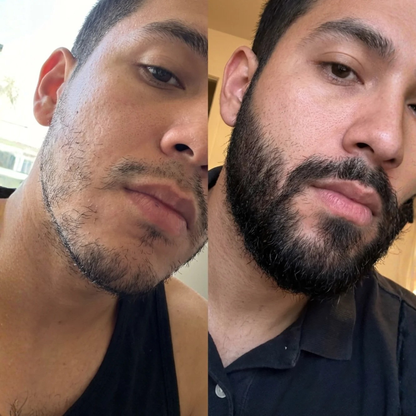 Bálsamo Apolo ORIGINAL (Minoxidil 20%) + Activador GRATIS | Barba Densa y Fuerte en Tan Solo 8 Semanas