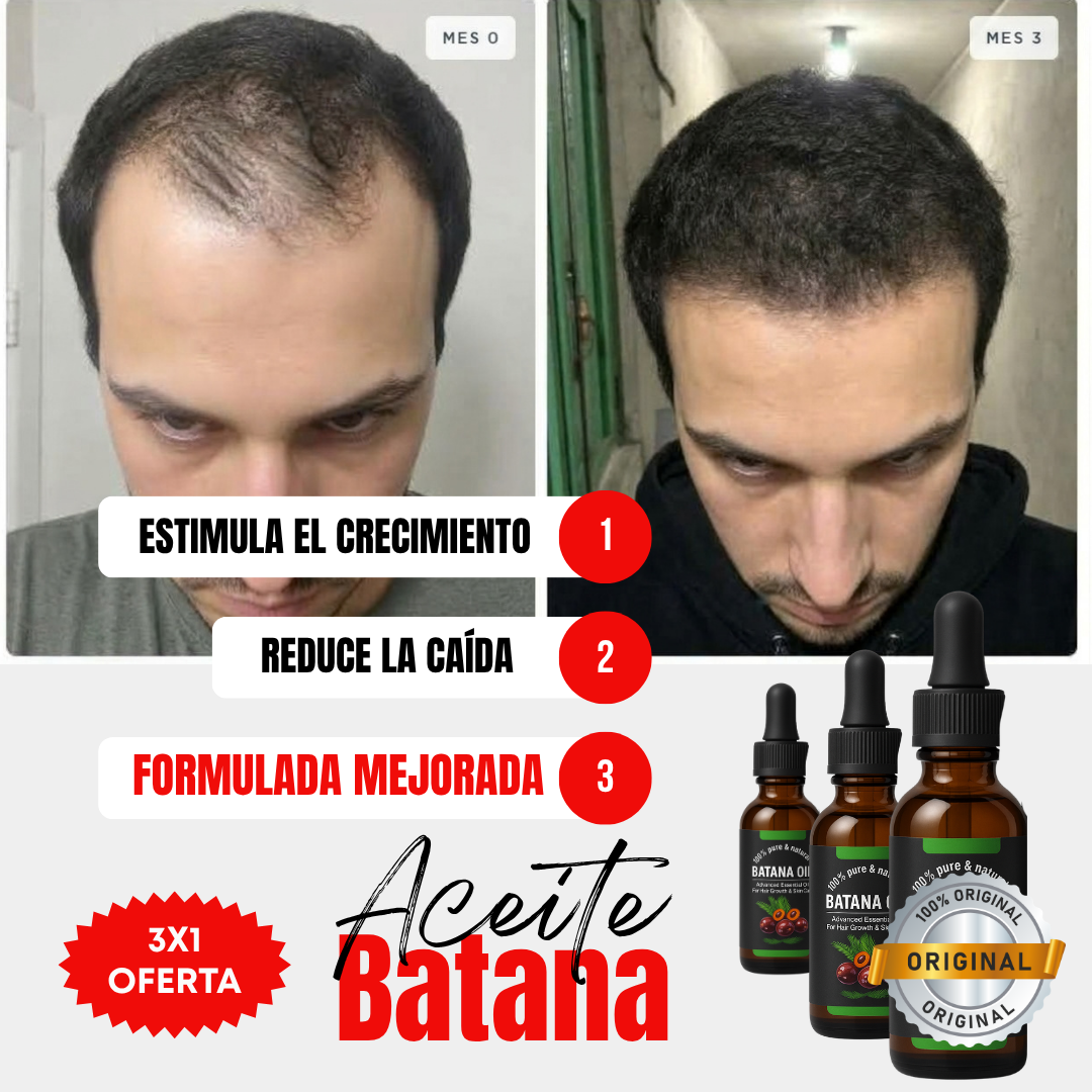Kit 3x1 | Aceite de Batana ORIGINAL (30ml) + ROMERO | Recupera tu Cabello Perdido en Tan Solo 8 Semanas