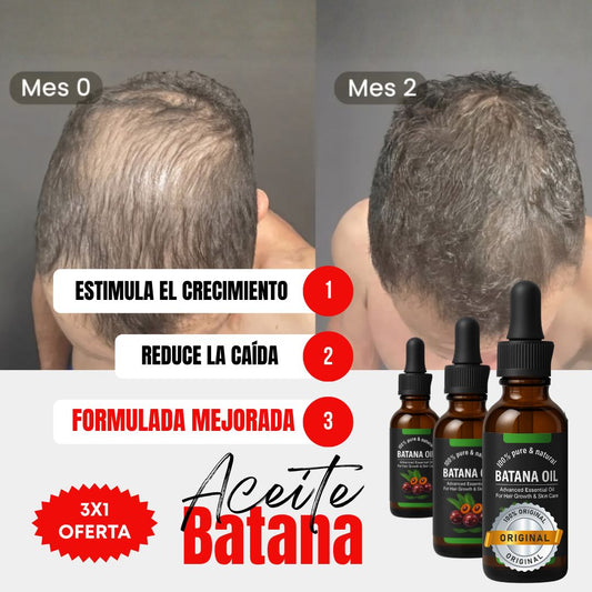 Kit x3 Frascos | Aceite Batana ORIGINAL + ROMERO | Estimula el Crecimiento del Cabello en 30 Días