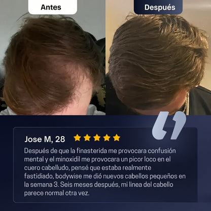 Sérum Capilar Bodywise (25ml) + Romero | El aceite que te ayuda a recuperar el cabello en pocas semanas