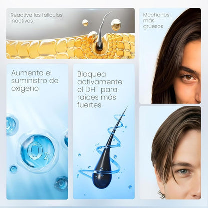 Sérum Capilar Bodywise (25ml) + Romero | El aceite que te ayuda a recuperar el cabello en pocas semanas