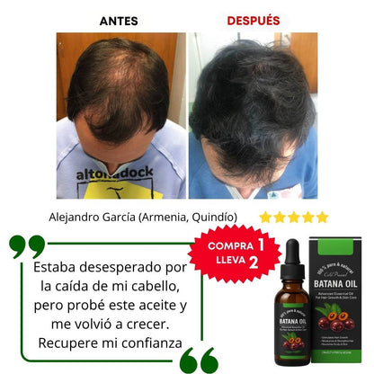 Aceite Batana ORIGINAL x2: El Secreto Ancestral para Prevenir la Caída del Cabello y Estimular el Crecimiento