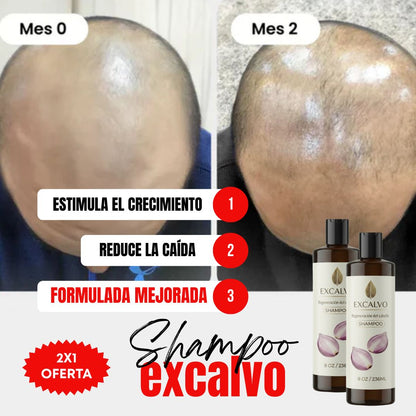 Kit 2x1 | Shampoo EXCALVO (236 ml) Cebolla + Romero | Recupera tu Cabello Perdido en Tan Solo 5 Semanas