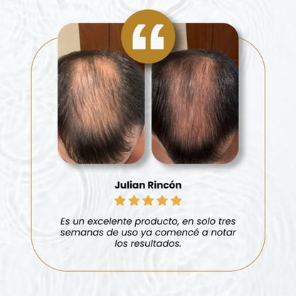 Jabón Polygonum™ - El secreto asiático para el crecimiento del cabello