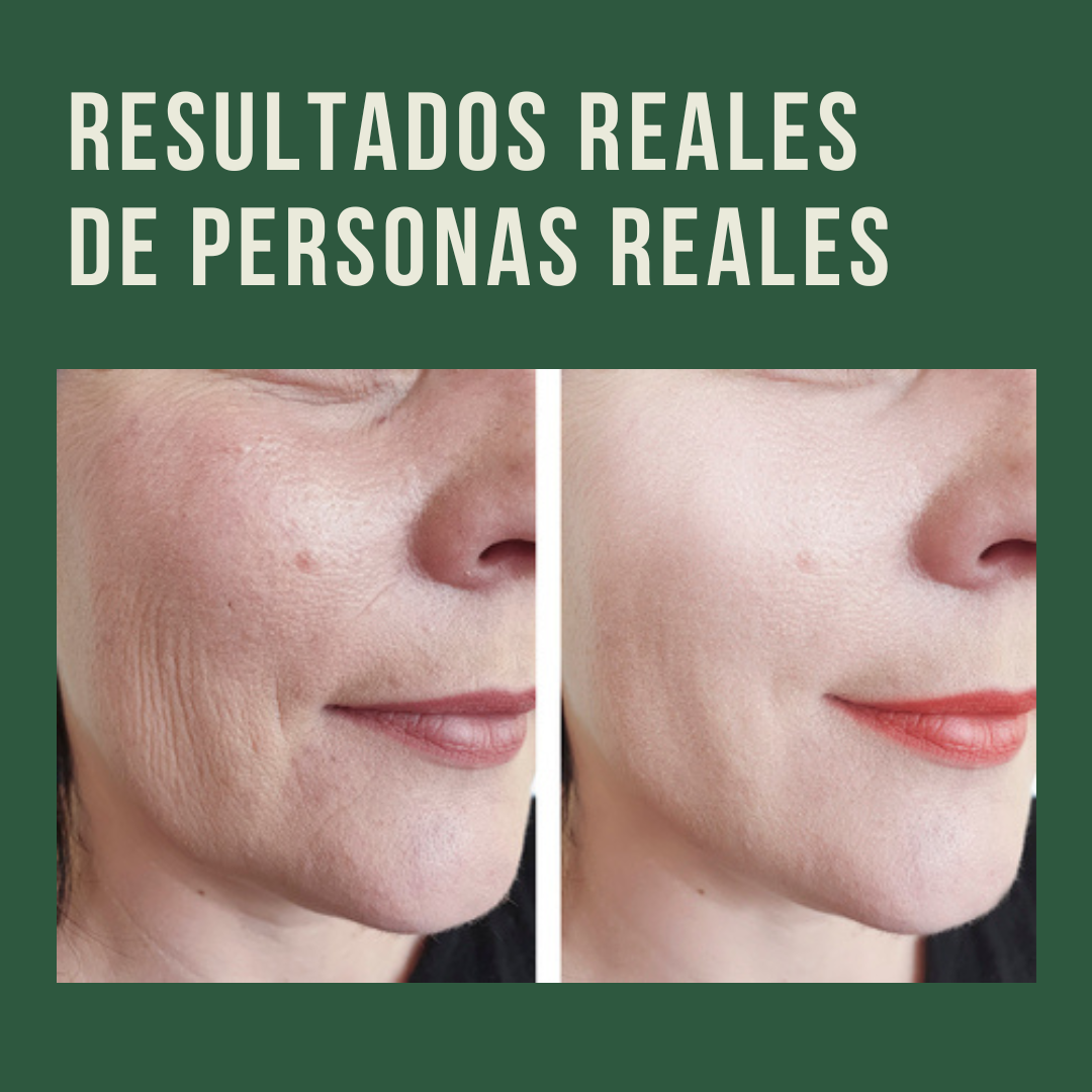 Compras 1 Llevas 2 | Crema Lovilds ORIGINAL (500ml) | Piel Más Firme y con Menos Arrugas En 4 Semanas