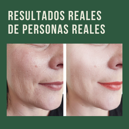 Compras 1 Llevas 2 | Crema Lovilds ORIGINAL (500ml) | Piel Más Firme y con Menos Arrugas En 4 Semanas
