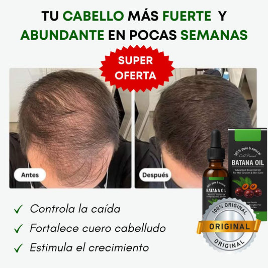 Aceite Batana ORIGINAL x2: El Secreto Ancestral para Prevenir la Caída del Cabello y Estimular el Crecimiento