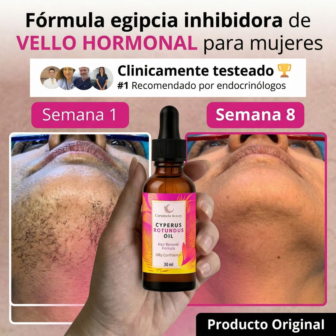 Cyperus Rotundus (30ml) | El aceite ideal para disminuir el crecimiento del vello corporal femenino