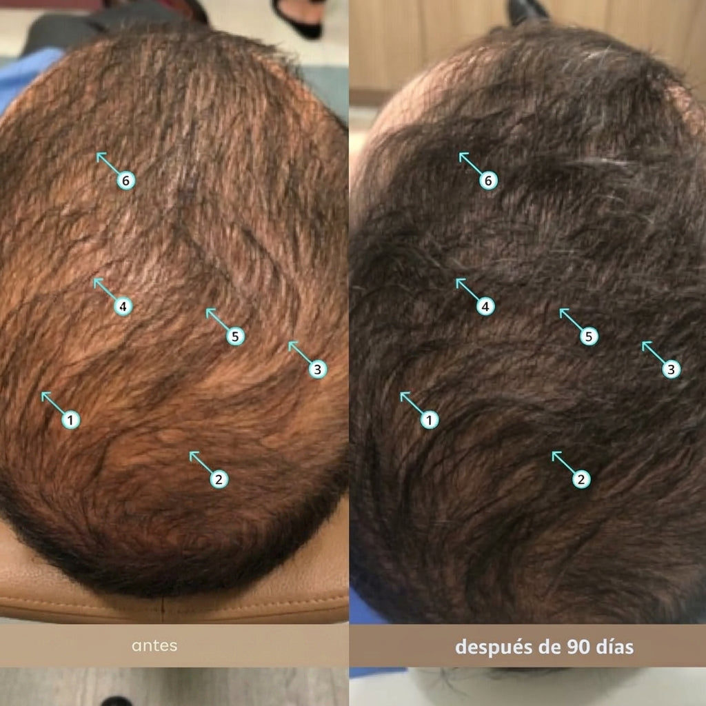 Serum Spectral Mens ORIGINAL (60ml) Nanoxidil 5% + Cafeína | Recupera tu Cabello en  8 Semanas