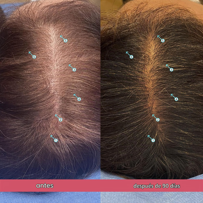 Serum Spectral Womens ORIGINAL (60ml) Nanoxidil 5% + Biotina | Recupera tu Cabello en  8 Semanas