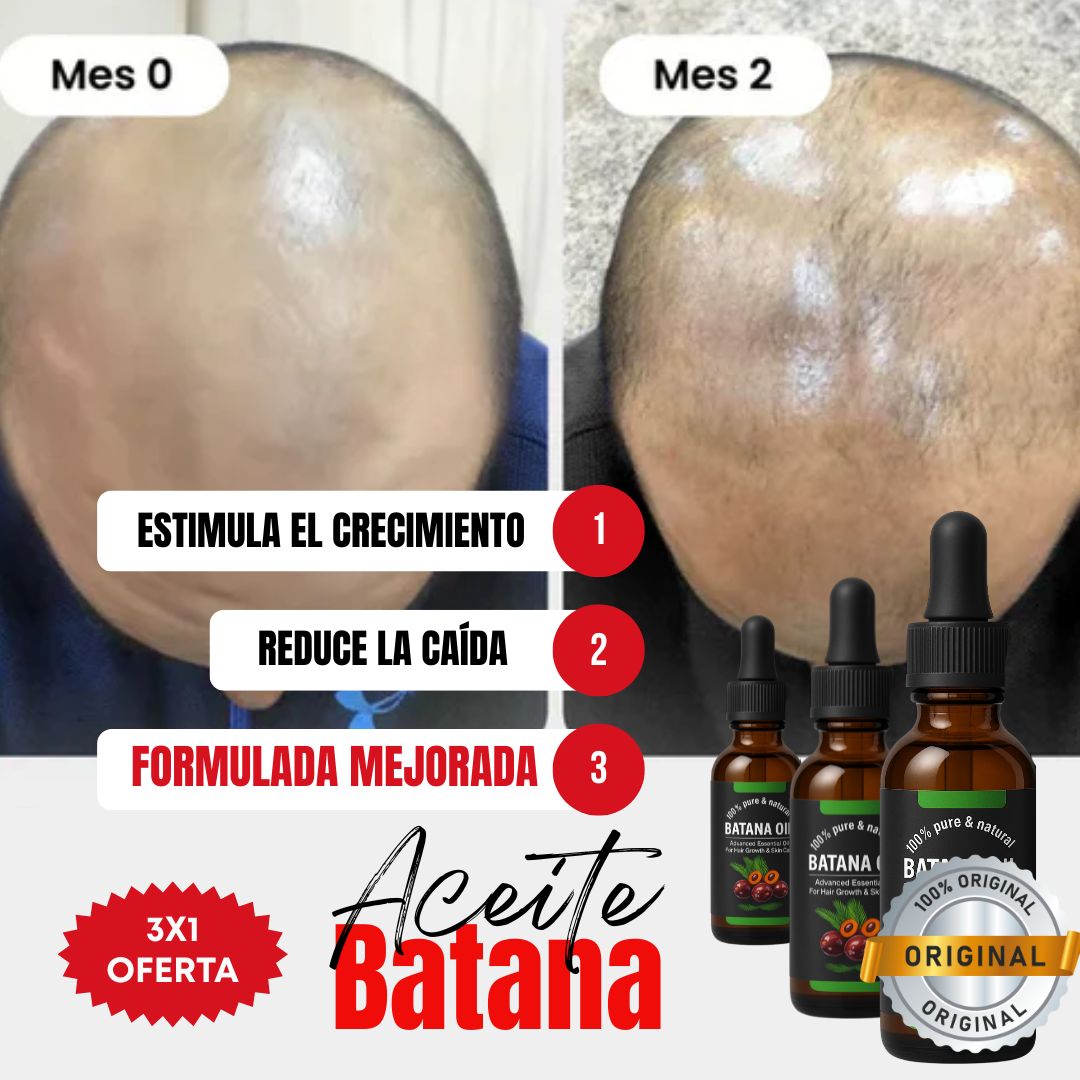 Kit 3x1 | Aceite de Batana ORIGINAL (30ml) + ROMERO | Recupera tu Cabello Perdido en Tan Solo 8 Semanas