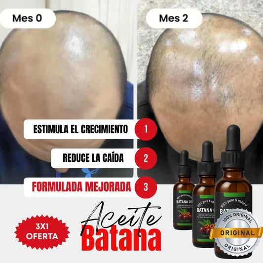 Kit 3x1 | Aceite de Batana ORIGINAL (30ml) + ROMERO | Recupera tu Cabello Perdido en Tan Solo 8 Semanas