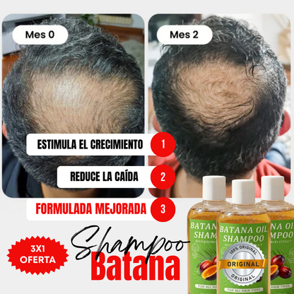 Kit 3x1 | Shampoo Batana ORIGINAL (300ml) + ROMERO | Recupera tu Cabello Perdido en Tan Solo 8 Semanas