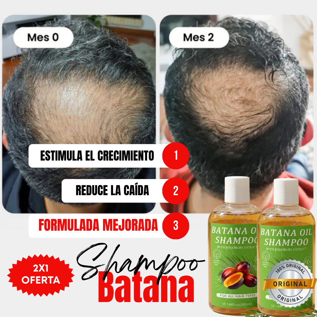 Kit 2x1 | Shampoo Batana ORIGINAL (300ml) + ROMERO | Recupera tu Cabello Perdido en Tan Solo 8 Semanas